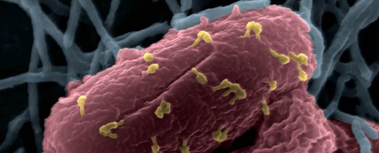 The image depicts a microscopic view of a bacterium with a distinct pink, granular appearance, surrounded by a complex web of cellular structures.

Le contenu généré par l’IA peut être incorrect.