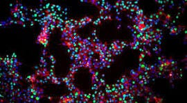 Japan approves two world's first iPS cell therapies